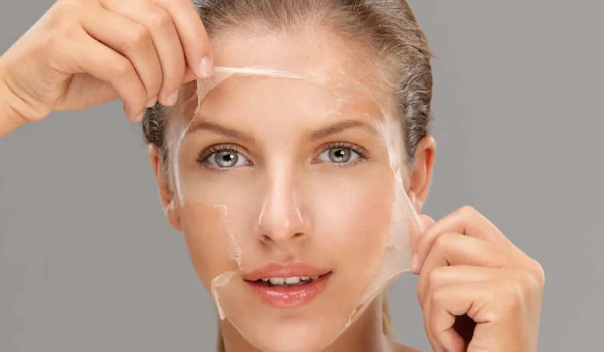 Woman undergoing chemical peel treatment to exfoliate skin and improve condition